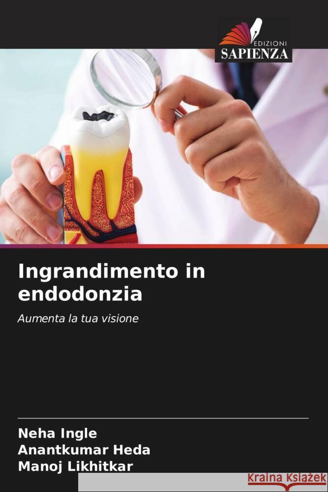 Ingrandimento in endodonzia Neha Ingle Anantkumar Heda Manoj Likhitkar 9786208077013 Edizioni Sapienza - książka