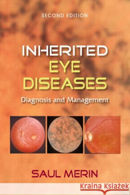 Inherited Eye Diseases: Diagnosis and Management Merin, Saul 9781574448399 Taylor & Francis Group - książka