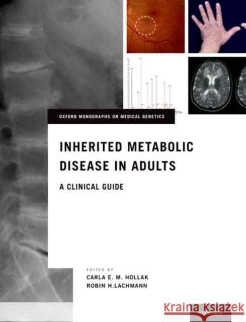 Inherited Metabolic Disease in Adults: A Clinical Guide Carla E. M. Hollak Robin Lachmann 9780199972135 Oxford University Press, USA - książka