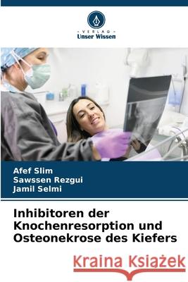 Inhibitoren der Knochenresorption und Osteonekrose des Kiefers Slim, Afef, rezgui, Sawssen, Selmi, Jamil 9786208496791 Verlag Unser Wissen - książka