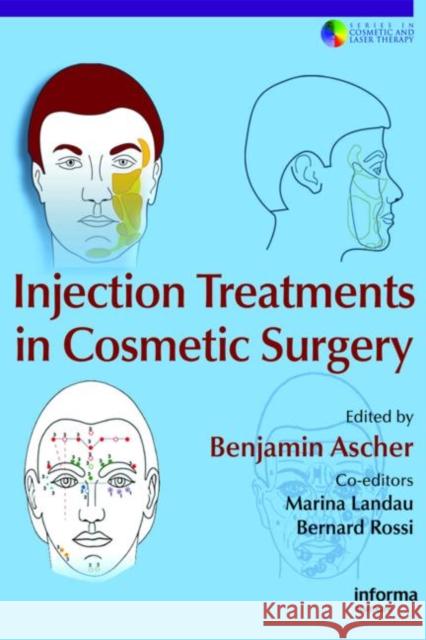 Injection Treatments in Cosmetic Surgery Ascher Ascher Bernard Ascher Benjamin Ascher 9780415386517 Informa Healthcare - książka