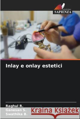 Inlay e onlay estetici R., Raghul, S., Ganesan, B., Swathika 9786202419840 Edizioni Sapienza - książka