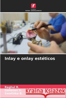 Inlay e onlay estéticos R., Raghul, S., Ganesan, B., Swathika 9786202419802 Edições Nosso Conhecimento - książka