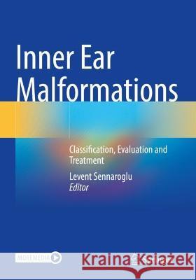 Inner Ear Malformations  9783030836764 Springer International Publishing - książka