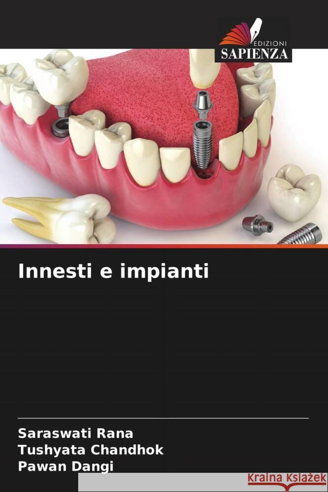 Innesti e impianti Rana, Saraswati, Chandhok, Tushyata, Dangi, Pawan 9786206575092 Edizioni Sapienza - książka