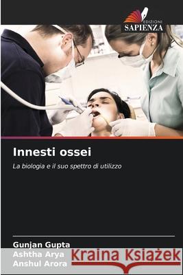 Innesti ossei Gupta, Gunjan, Arya, Ashtha, Arora, Anshul 9786208799762 Edizioni Sapienza - książka