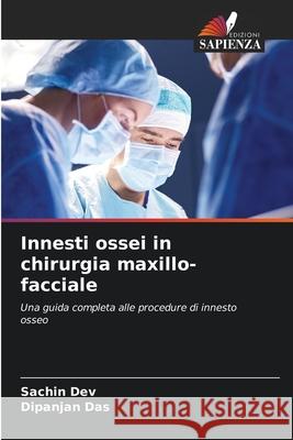 Innesti ossei in chirurgia maxillo-facciale DEV, SACHIN, Das, Dipanjan 9786208721992 Edizioni Sapienza - książka