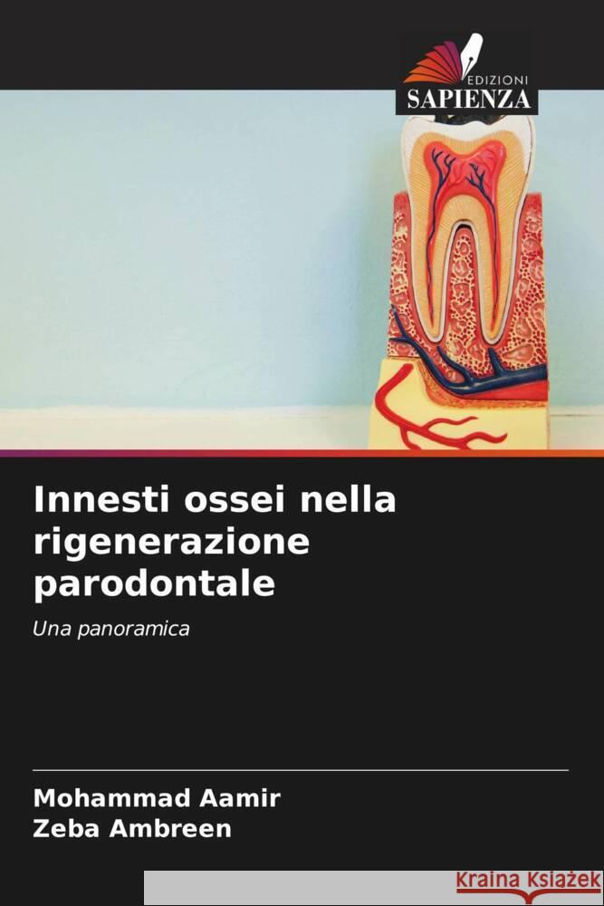 Innesti ossei nella rigenerazione parodontale Mohammad Aamir Zeba Ambreen 9786208634674 Edizioni Sapienza - książka