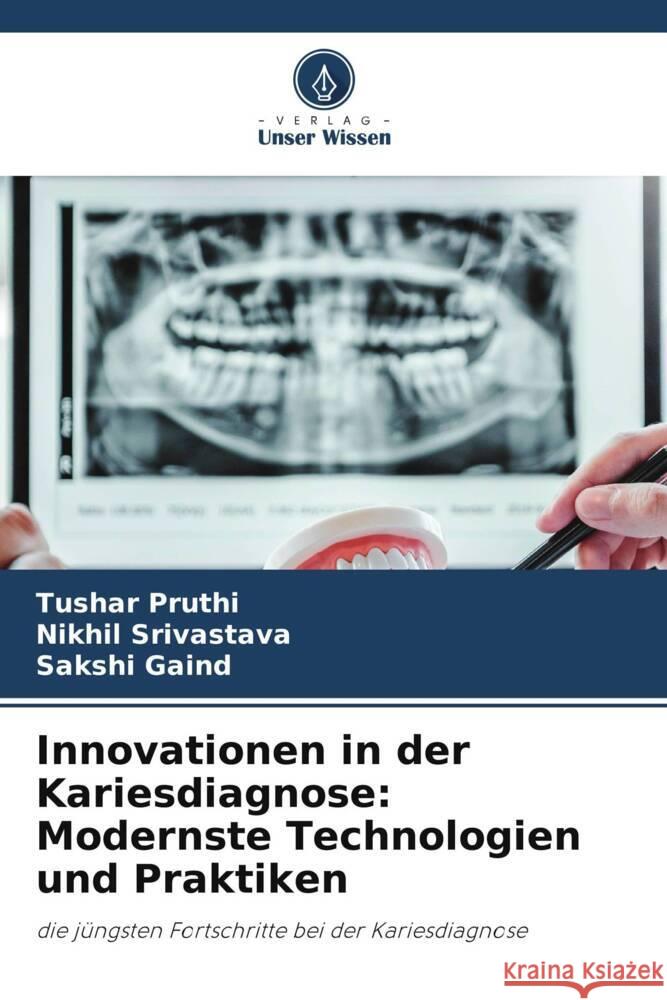 Innovationen in der Kariesdiagnose: Modernste Technologien und Praktiken Pruthi, Tushar, Srivastava, Nikhil, Gaind, Sakshi 9786203613995 Verlag Unser Wissen - książka