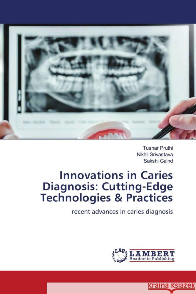 Innovations in Caries Diagnosis: Cutting-Edge Technologies & Practices Pruthi, Tushar, Srivastava, Nikhil, Gaind, Sakshi 9783659625244 LAP Lambert Academic Publishing - książka