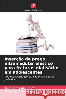 Inserção de prego intramedular elástico para fraturas diafisárias em adolescentes Khan, Abdul Qayyum, Sherwani, M. K. A. 9786209279331 Edições Nosso Conhecimento - książka