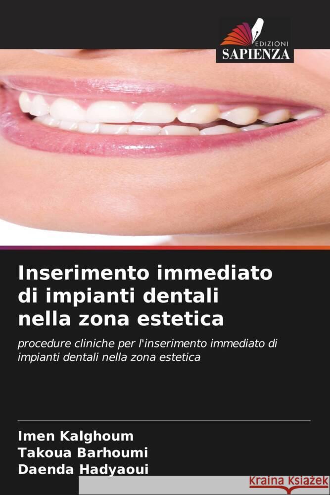 Inserimento immediato di impianti dentali nella zona estetica Kalghoum, Imen, Barhoumi, Takoua, Hadyaoui, Daenda 9786206435136 Edizioni Sapienza - książka