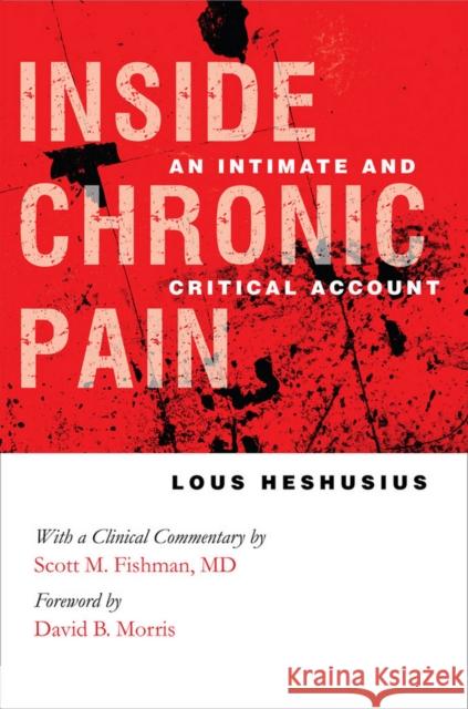 Inside Chronic Pain Heshusius, Lous 9780801447969 ILR Press - książka