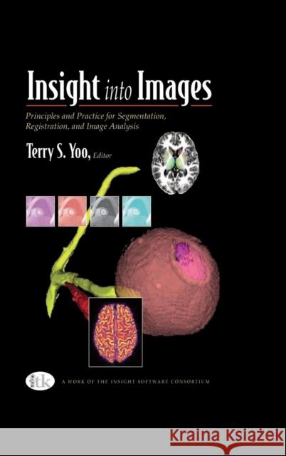 Insight into Images: Principles and Practice for Segmentation, Registration, and Image Analysis Yoo, Terry S. 9781568812175  - książka
