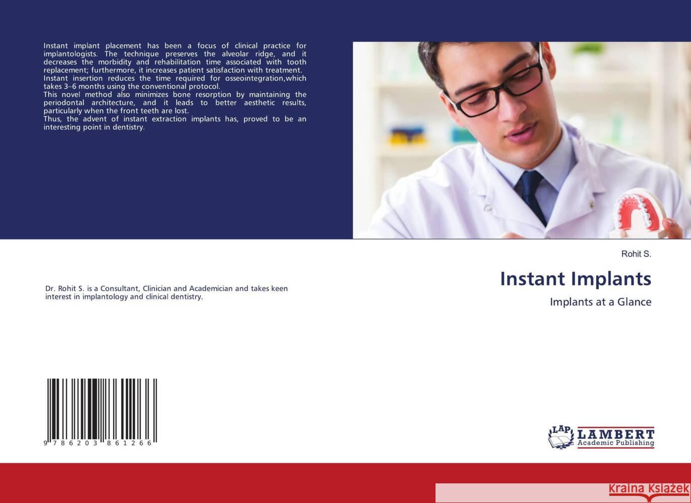 Instant Implants S., Rohit 9786203861266 LAP Lambert Academic Publishing - książka