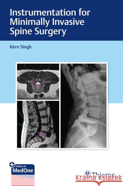 Instrumentation for Minimally Invasive Spine Surgery Kern Singh 9781626232020 Thieme Medical Publishers - książka