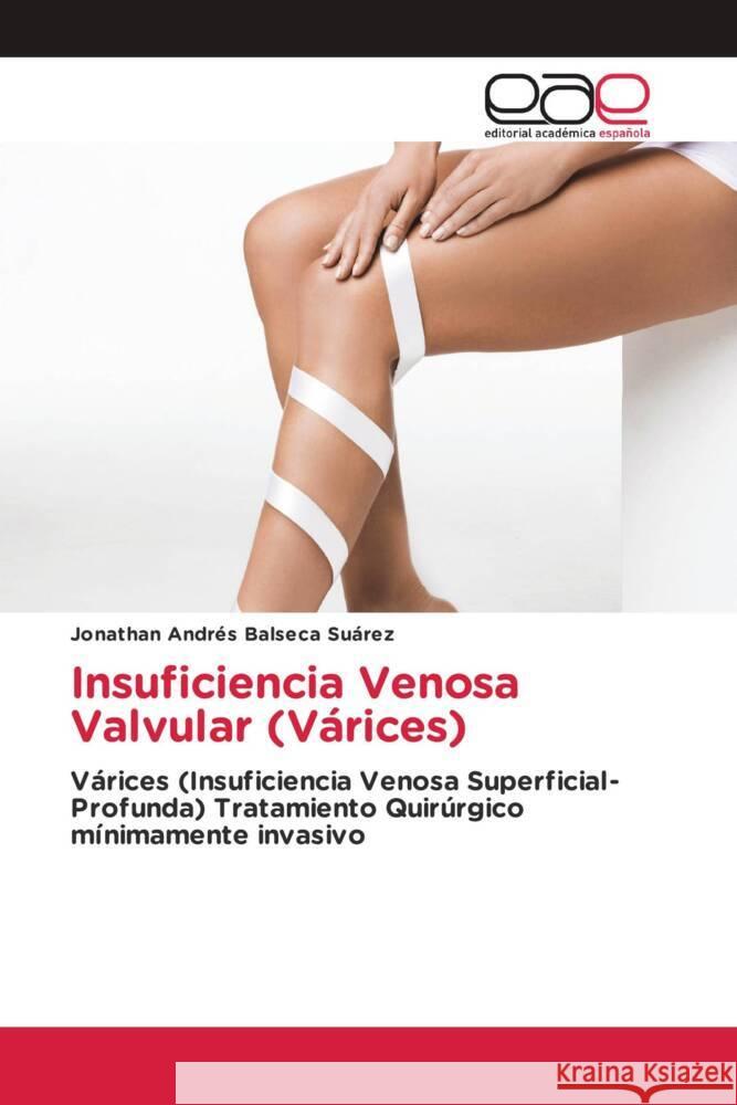 Insuficiencia Venosa Valvular (Várices) Balseca Suárez, Jonathan Andrés 9786203879087 Editorial Académica Española - książka