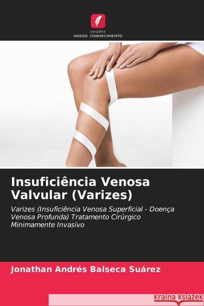 Insuficiência Venosa Valvular (Varizes) Balseca Suárez, Jonathan Andrés 9786204232027 Edicoes Nosso Conhecimento - książka