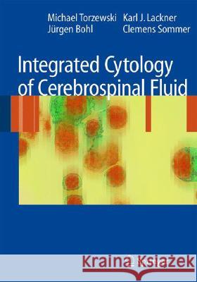Integrated Cytology of Cerebrospinal Fluid Michael Torzewski Karl J. Lackner J??rgen Bohl 9783540758846 Not Avail - książka