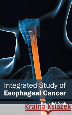 Integrated Study of Esophageal Cancer Frederick Nash 9781632422491 Foster Academics - książka