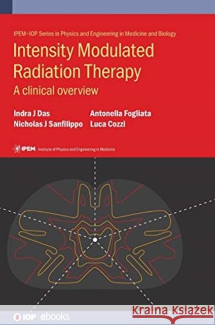 Intensity Modulated Radiation Therapy: A clinical overview Das, Indra J. 9780750313360 Iop Publishing Ltd - książka