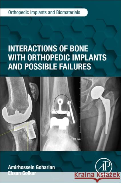 Interactions of Bone with Orthopedic Implants and Possible Failures Amirhossein Goharian 9780323954105 Academic Press - książka