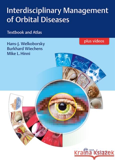 Interdisciplinary Management of Orbital Diseases: Textbook and Atlas Welkoborsky, Hans-Jürgen 9783131994219 Tps - książka