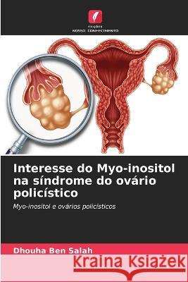 Interesse do Myo-inositol na síndrome do ovário policístico Ben Salah, Dhouha 9786205300985 Edicoes Nosso Conhecimento - książka
