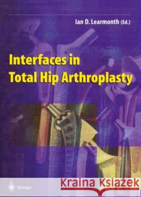Interfaces in Total Hip Arthroplasty  9781447111504  - książka
