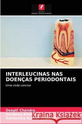 Interleucinas NAS Doenças Periodontais Deepti Chandra, Sandeep Khuba, Amitandra Kumar Tripathi 9786202819145 Edicoes Nosso Conhecimento - książka