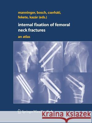 Internal Fixation of Femoral Neck Fractures: An Atlas Manninger, Jenó 9783211685839 Springer - książka