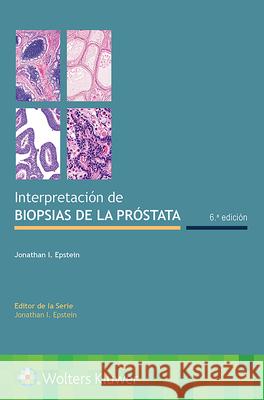 Interpretación de Biopsias de la Próstata Epstein, Jonathan I. 9788418257285 LWW - książka