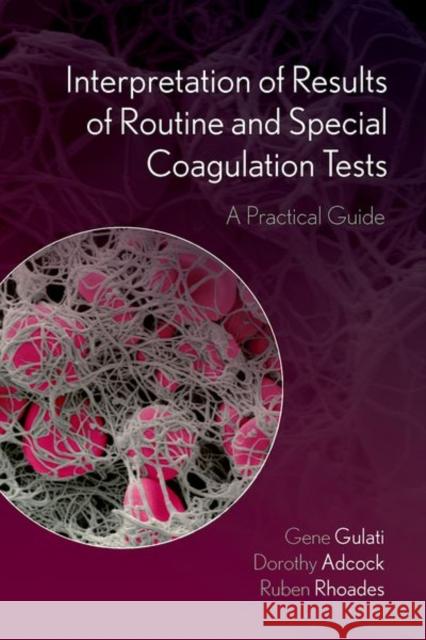 Interpretation of Results of Routine and Special Coagulation Tests: A Practical Guide Ruben (Assistant Professor of Medicine, Division of Hematology, Director, Assistant Professor of Medicine, Division of H 9780197795439 Oxford University Press - książka