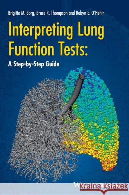 Interpreting Lung Function Tests: A Step-By Step Guide Borg, Brigitte M. 9781118405512 Wiley-Blackwell - książka