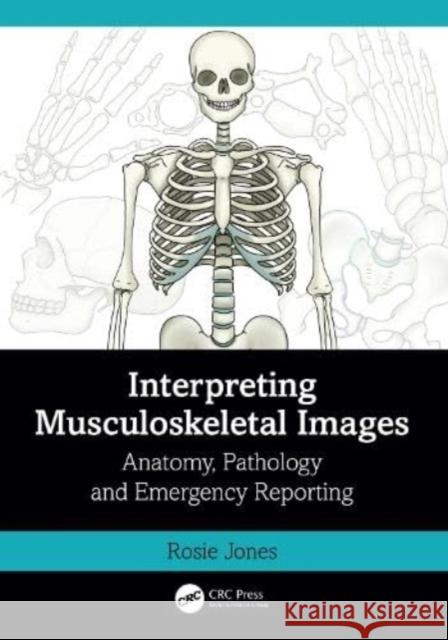 Interpreting Musculoskeletal Images: Anatomy, Pathology and Emergency Reporting Rosie Jones 9781032398914 Taylor & Francis Ltd - książka