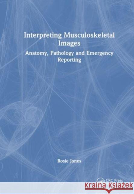 Interpreting Musculoskeletal Images: Anatomy, Pathology and Emergency Reporting Rosie Jones 9781032409382 CRC Press - książka