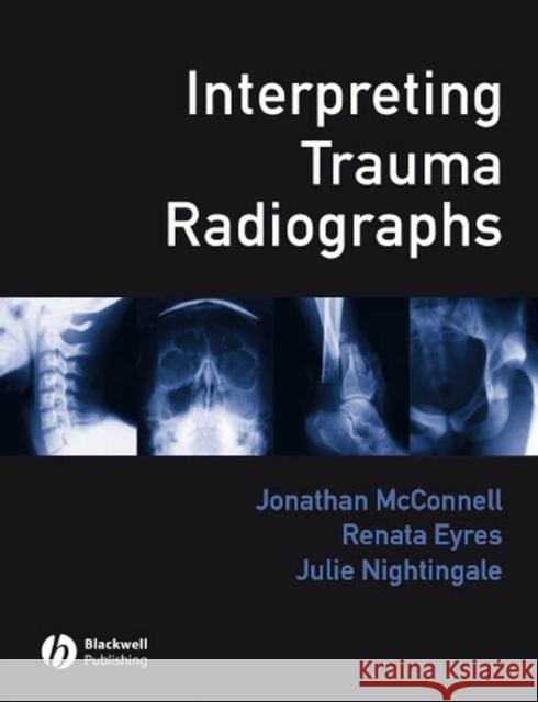 Interpreting Trauma Radiographs Jonathan McConnell Renata Eyres Julie Nightingale 9781405115346 Blackwell Publishers - książka