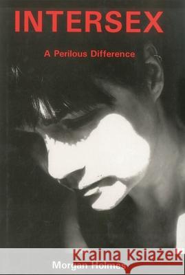 Intersex: A Perilous Difference Holmes, Morgan 9781575911175 Susquehanna University Press - książka
