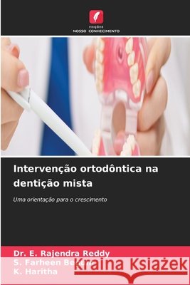Interven??o ortod?ntica na denti??o mista E. Rajendra Reddy S. Farheen Begum K. Haritha 9786630235487 Edicoes Nosso Conhecimento - książka