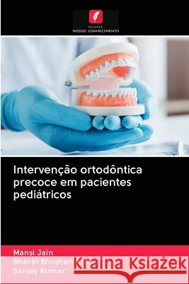 Intervenção ortodôntica precoce em pacientes pediátricos Jain, Mansi; Bhushan A. K., Bharat; Kumar, Sanjay 9786202865043 Edicoes Nosso Conhecimento - książka