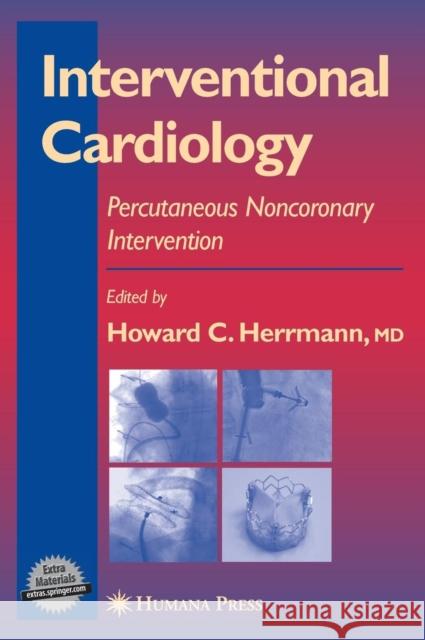 Interventional Cardiology: Percutaneous Noncoronary Intervention Herrmann, Howard C. 9781588293671 Humana Press - książka