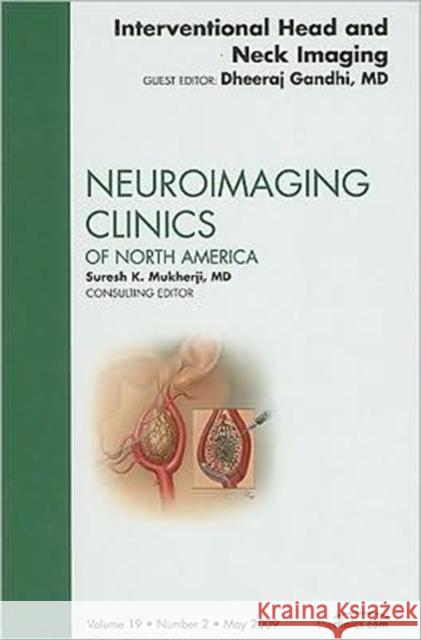 Interventional Head and Neck Imaging, an Issue of Neuroimaging Clinics: Volume 19-2 Gandhi, Dheeraj 9781437705034 W.B. Saunders Company - książka