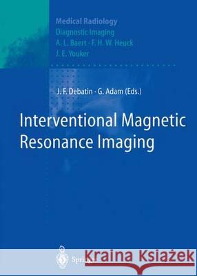 Interventional Magnetic Resonance Imaging J. Rg F. Debatin Gerhard Adam A. L. Baert 9783642643293 Springer - książka