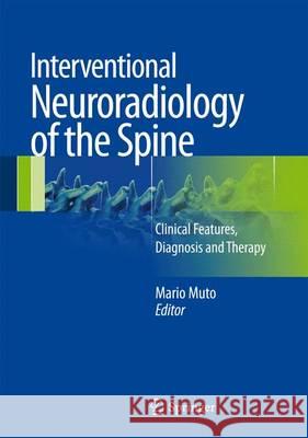 Interventional Neuroradiology of the Spine: Clinical Features, Diagnosis and Therapy Mario Muto 9788847027893 Springer Verlag - książka