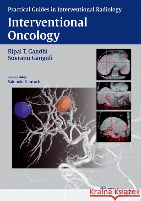 Interventional Oncology Suvranu Ganguli Ripal T. Gandhi Salomao Faintuch 9781626230811 Thieme Medical Publishers - książka