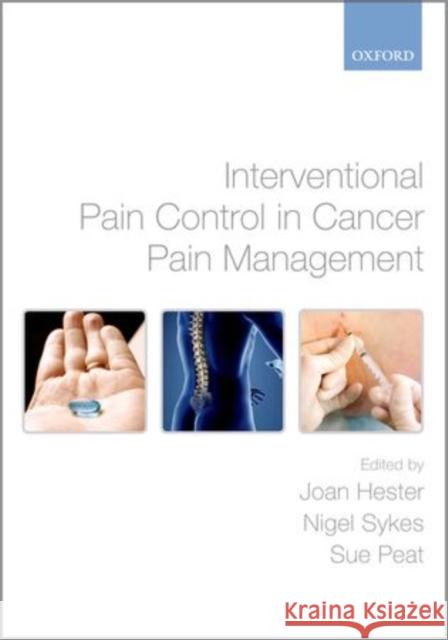 Interventional Pain Control in Cancer Pain Management Joan Hester 9780199219087  - książka