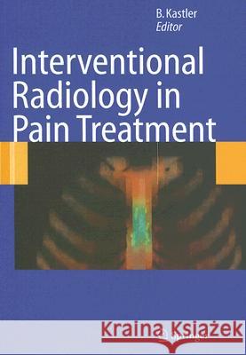 Interventional Radiology in Pain Treatment Bruno Kastler Fabrice-Guy Barral Bernard Fergane 9783540248101 Springer - książka
