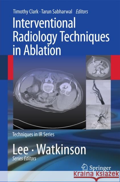 Interventional Radiology Techniques in Ablation  Clark 9780857290939 Springer, Berlin - książka