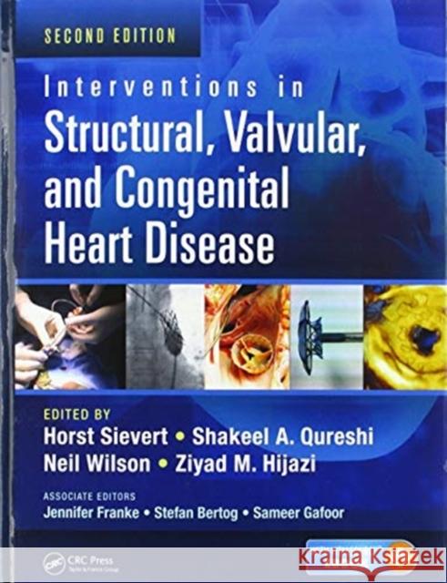 Interventions in Structural, Valvular and Congenital Heart Disease Horst Sievert Shakeel A. Qureshi Neil Wilson 9780367575984 CRC Press - książka