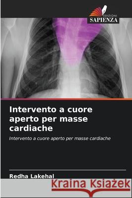 Intervento a cuore aperto per masse cardiache Lakehal, Redha 9786209250880 Edizioni Sapienza - książka